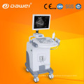 DW370 meilleure machine d&#39;échographie vaginale et machine diagnostique médicale d&#39;ultrason avec le meilleur prix et service